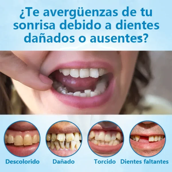 DIYSTAR™ - Prótesis Dental Premium