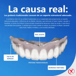 DIYSTAR™ - Prótesis Dental Premium