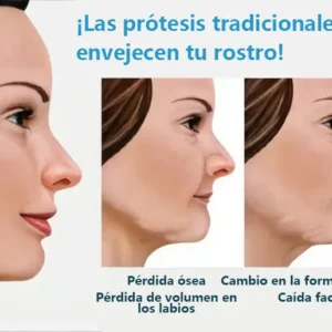 DIYSTAR™ - Prótesis Dental Premium