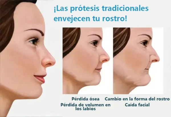 DIYSTAR™ - Prótesis Dental Premium