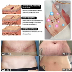 (🔥LAST DAY SALE-80%OFF) DIYSTAR 💖 Lymphatic Magnetic Therapy Diamond Ring