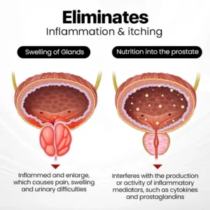 (โฐ๐๐ข๐ฆ๐ข๐ญ๐๐ ๐ญ๐ข๐ฆ๐ ๐๐ข๐ฌ๐๐จ๐ฎ๐ง๐ญ ๐๐๐ฌ๐ญ ๐๐ ๐ฆ๐ข๐ง๐ฎ๐ญ๐๐ฌโฐ)DIYSTARโข ProstaAir Dual-Function Nasal Inhaler