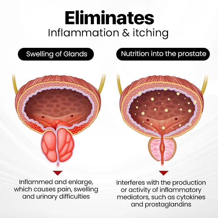 (โฐ๐๐ข๐ฆ๐ข๐ญ๐๐ ๐ญ๐ข๐ฆ๐ ๐๐ข๐ฌ๐๐จ๐ฎ๐ง๐ญ ๐๐๐ฌ๐ญ ๐๐ ๐ฆ๐ข๐ง๐ฎ๐ญ๐๐ฌโฐ)DIYSTARโข ProstaAir Dual-Function Nasal Inhaler