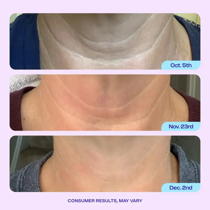 DIYSTAR Neck Cream Tighten & Lift Firming Cream for Crepey Skin