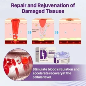 Misspone™ Curcumin & Emu Oil Pain Gel